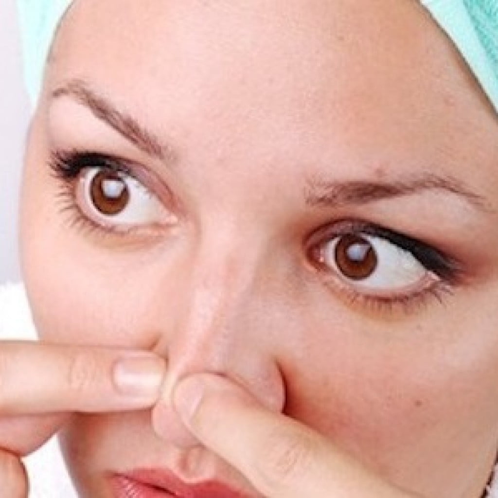 trucos eliminar puntos negros