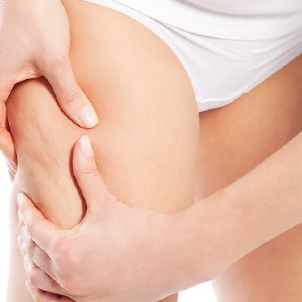 remedios caseros eliminar celulitis