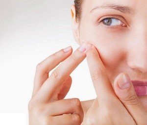 El acné quístico: causas y tratamiento