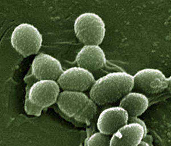 bacteria-enterococcus-faecalis