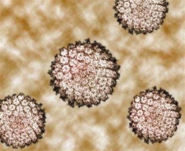 ¿El virus del papiloma humano se cura?