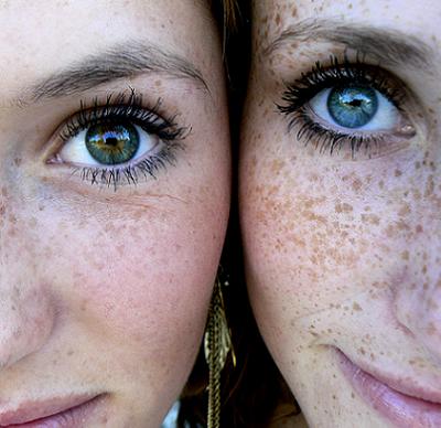 Síndrome del ovario poliquístico y retrasos en la regla